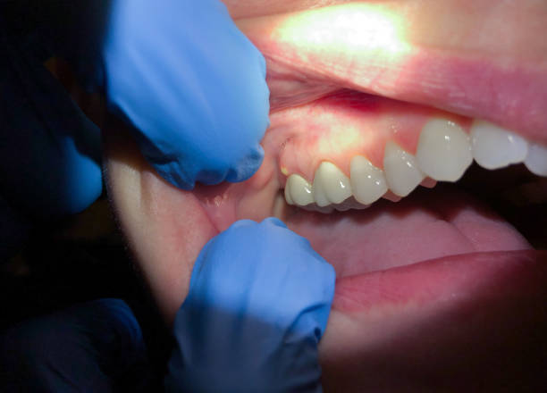 Best Emergency TMJ Treatment in Farragut, TN
