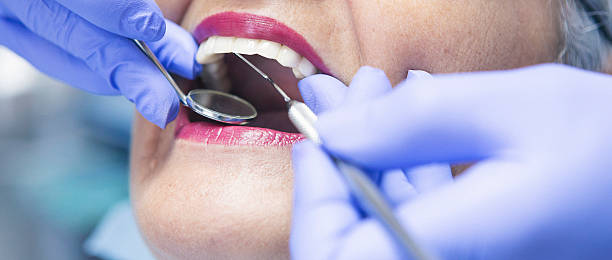 Best Emergency Wisdom Teeth Removal in Farragut, TN